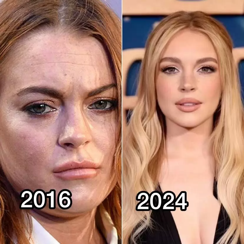 Донателла Версаче: преображение, которое шокировало мир